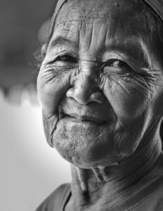 大人ニキビに効果的な皮膚科処方薬とは？
