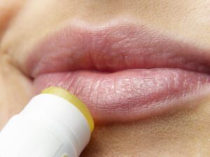 美肌を目指すための皮膚科相談の料金はどれくらい？